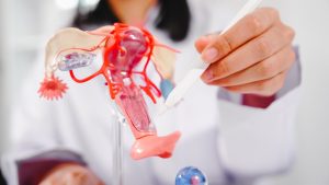Doctor points to bladder on female anatomy model, explaining pelvic pain and IC symptoms.